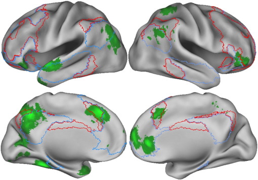 Mind_wandering_spontaneous_thought_brain_activations Wikimedia